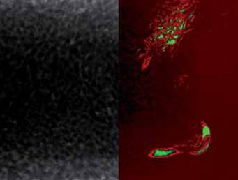 The conventional image (left) and the dynamic image (right) of a pack of rice containing mealworm larvae